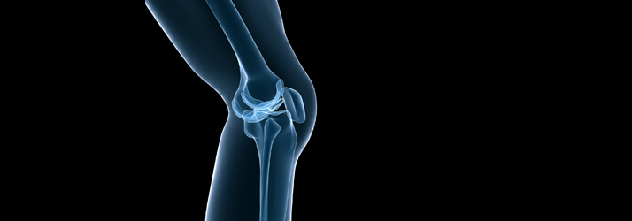 Cryotherapy during the Acute Phase of Injury in Buellton